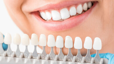 How To Take Care of Your Dental Implants