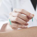 Dry Needling Therapy clinic in Lahore