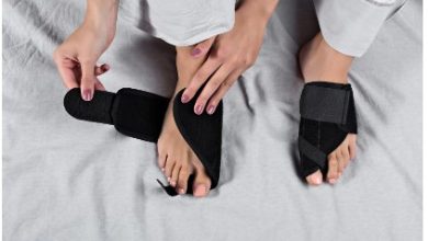 How to Prepare for Bunion Surgery